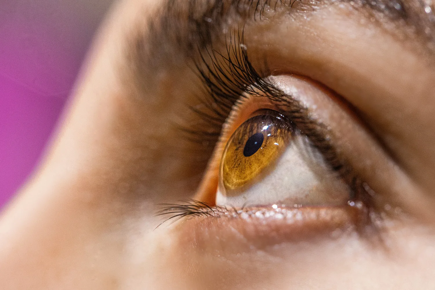 Desprendimiento de retina